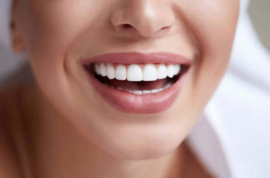 20 Yaş Dişleri ve Ortodontik Tedavi İlişkisi