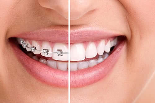Ağız ve Diş Tedavisinde Devlet Desteğinden Nasıl Yararlanılır?