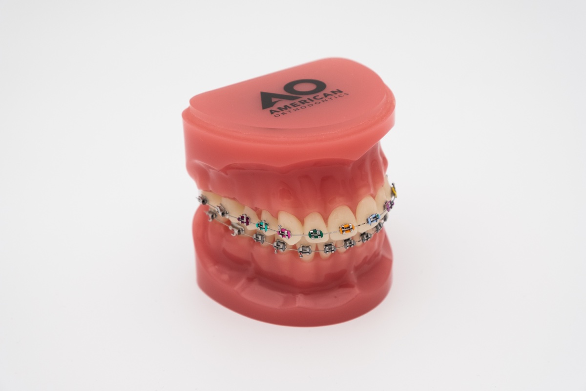 Eskişehir Diş Teli – Ortodonti Hizmeti